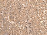 WDFY3 Antibody in Immunohistochemistry (Paraffin) (IHC (P))