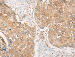 ZXDA Antibody in Immunohistochemistry (Paraffin) (IHC (P))