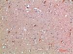 IL18RAP Antibody in Immunohistochemistry (Paraffin) (IHC (P))