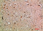 IL18RAP Antibody in Immunohistochemistry (Paraffin) (IHC (P))