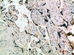 INHA Antibody in Immunohistochemistry (Paraffin) (IHC (P))