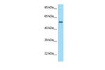 ZBTB37 Antibody in Western Blot (WB)