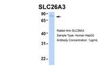 SLC26A3 Antibody in Western Blot (WB)