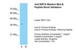 SIRT4 Antibody in Western Blot (WB)