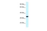 HEY1 Antibody in Western Blot (WB)