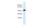 ZHX1 Antibody in Western Blot (WB)