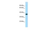 WNT8B Antibody in Western Blot (WB)