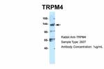 TRPM4 Antibody in Western Blot (WB)