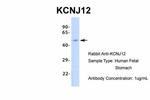 Kir2.2 (KCNJ12) Antibody in Western Blot (WB)