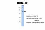 Kir2.2 (KCNJ12) Antibody in Western Blot (WB)