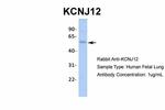 Kir2.2 (KCNJ12) Antibody in Western Blot (WB)