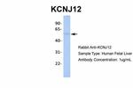 Kir2.2 (KCNJ12) Antibody in Western Blot (WB)