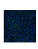 HTR3E Antibody in Immunohistochemistry (IHC)