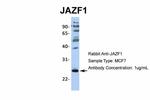 JAZF1 Antibody in Western Blot (WB)