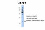 JAZF1 Antibody in Western Blot (WB)