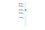 ESX1 Antibody in Western Blot (WB)