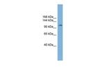 Progesterone Receptor Antibody in Western Blot (WB)