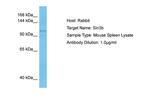 SIN3B Antibody in Western Blot (WB)