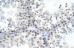 TFAM Antibody in Immunohistochemistry (IHC)