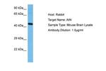 ATF4 Antibody in Western Blot (WB)