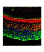 ATF4 Antibody in Immunohistochemistry (IHC)