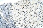 RNF6 Antibody in Immunohistochemistry (IHC)