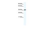 OBOX6 Antibody in Western Blot (WB)