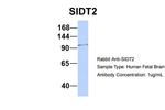 SIDT2 Antibody in Western Blot (WB)