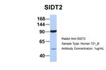 SIDT2 Antibody in Western Blot (WB)