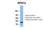 RPS14 Antibody in Western Blot (WB)