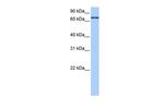 ADAD2 Antibody in Western Blot (WB)