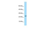 IL17B Antibody in Western Blot (WB)