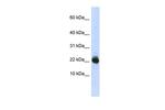 UBE2L3 Antibody in Western Blot (WB)