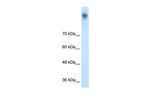 NKCC1 Antibody in Western Blot (WB)