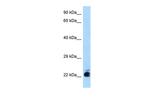 CTR1 Antibody in Western Blot (WB)