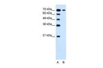 SLC5A4 Antibody in Western Blot (WB)