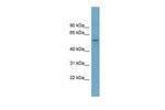 SLC22A15 Antibody in Western Blot (WB)