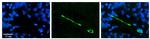 MTUS1 Antibody in Immunohistochemistry (Paraffin) (IHC (P))