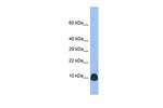 ATP6V0B Antibody in Western Blot (WB)