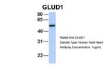 GluD1 Antibody in Western Blot (WB)