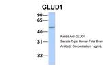 GluD1 Antibody in Western Blot (WB)