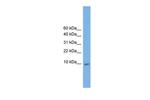 KRTAP23-1 Antibody in Western Blot (WB)