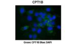 CPT1B Antibody in Immunocytochemistry (ICC/IF)