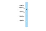 GALNT2 Antibody in Western Blot (WB)