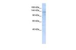 IMPG2 Antibody in Western Blot (WB)