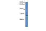 CLEC1B Antibody in Western Blot (WB)