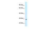 TMEM106B Antibody in Western Blot (WB)