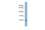 LBX2 Antibody in Western Blot (WB)