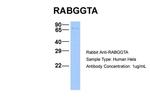 RABGGTA Antibody in Western Blot (WB)