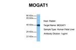 MOGAT1 Antibody in Western Blot (WB)